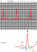 3-Second Strip